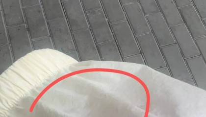 事发大连!天降痰液落在女子身上,她当场报警!此前同一地点……