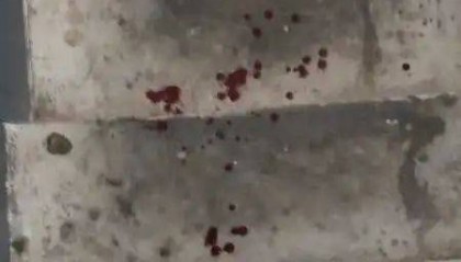 男子斥责遛狗不拴绳被打出血,次日送娃上学遭挑衅尾随,狗主人已被刑拘