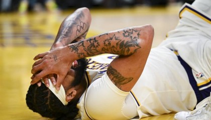 万幸!浓眉:不需要戴护目镜 已为明天比赛做好准备