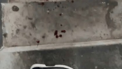 评论丨“我家狗不咬人”引发流血冲突,“犬患”背后首先是管好人