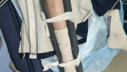 惨痛!一人身亡!深圳多名学生骑电动车发生意外