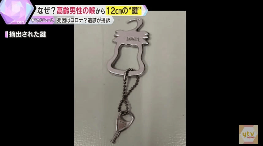 日本82岁老人喉咙痛被确诊新冠病死， X光发现是钥匙卡喉咙